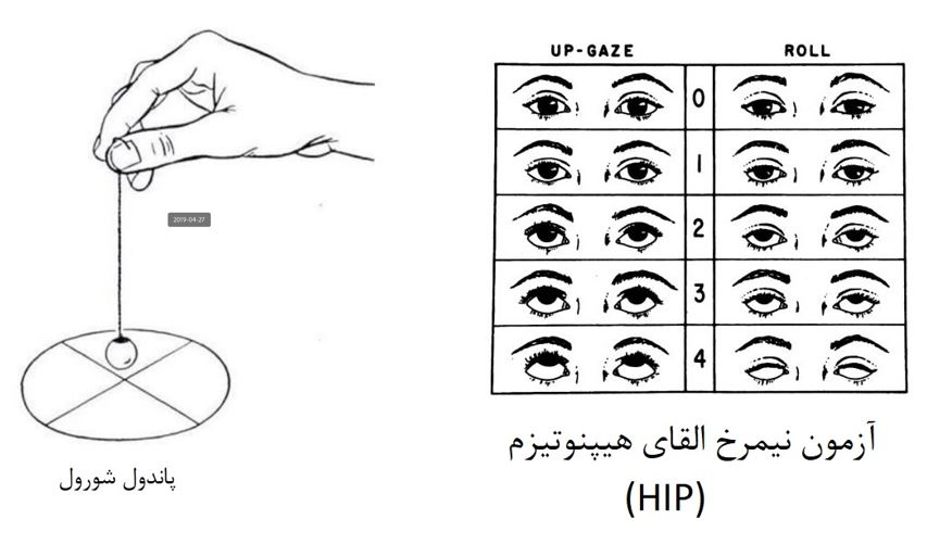 آزمون نیمرخ القا هیپنوتیزم